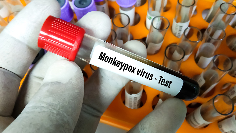 Image: WHO: Monkeypox outbreak traced to homosexual men who attended rave events in Europe