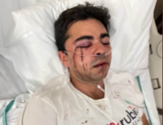 VIOLENT LEFTISTS BRUTALLY ATTACK Marco Rubio Canvasser – 4 Animals Beat Him Causing Internal Bleeding and Broken Jaw