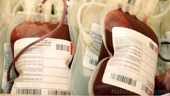 Unvaccinated blood banks? Learn about the growing movement for clean transfusions - Survive the News