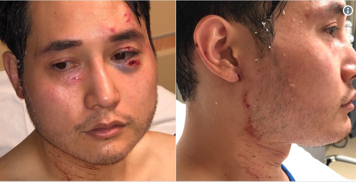 LEFT CULT: Portland jury absolves Antifa members of physical and emotional violence committed against investigative journalist Andy Ngo