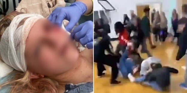 HORROR: Helpless Georgia Girl Stabbed Multiple Times at School, Leaving Her with Life-Altering Injuries - Lawsuit Alleges School Did NOTHING to Protect The Victim and Violated District Policy (VIDEO) | The Gateway Pundit